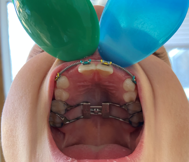 Virtual orthodontics