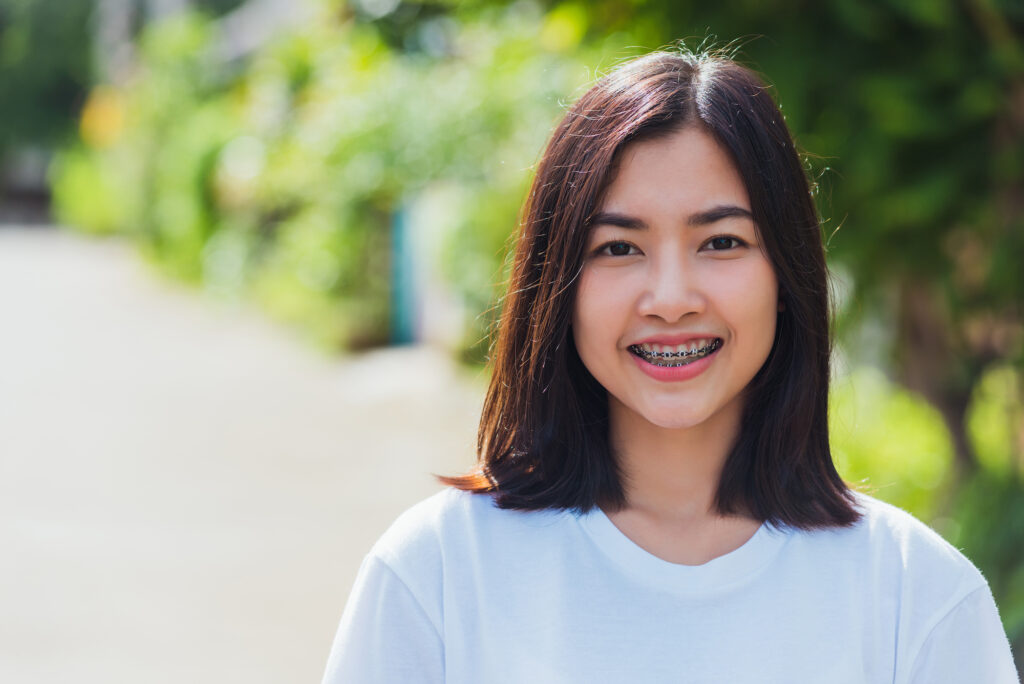 Clear Aligners vs. Traditional Braces: Which Treatment Fits Your Lifestyle?